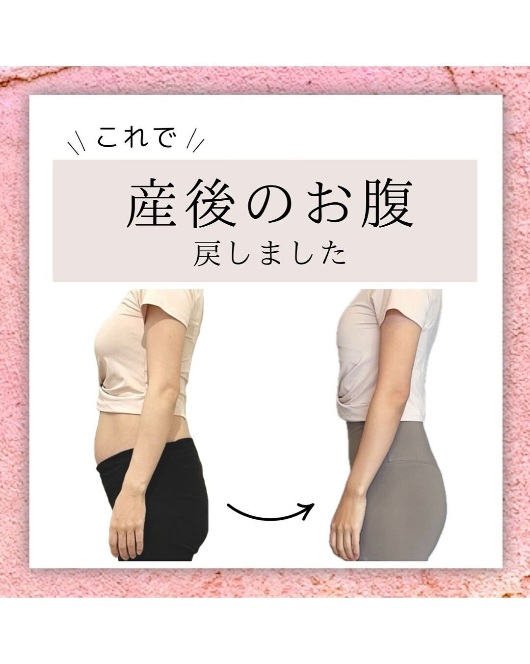 産後のお腹で悩んでいる方へ