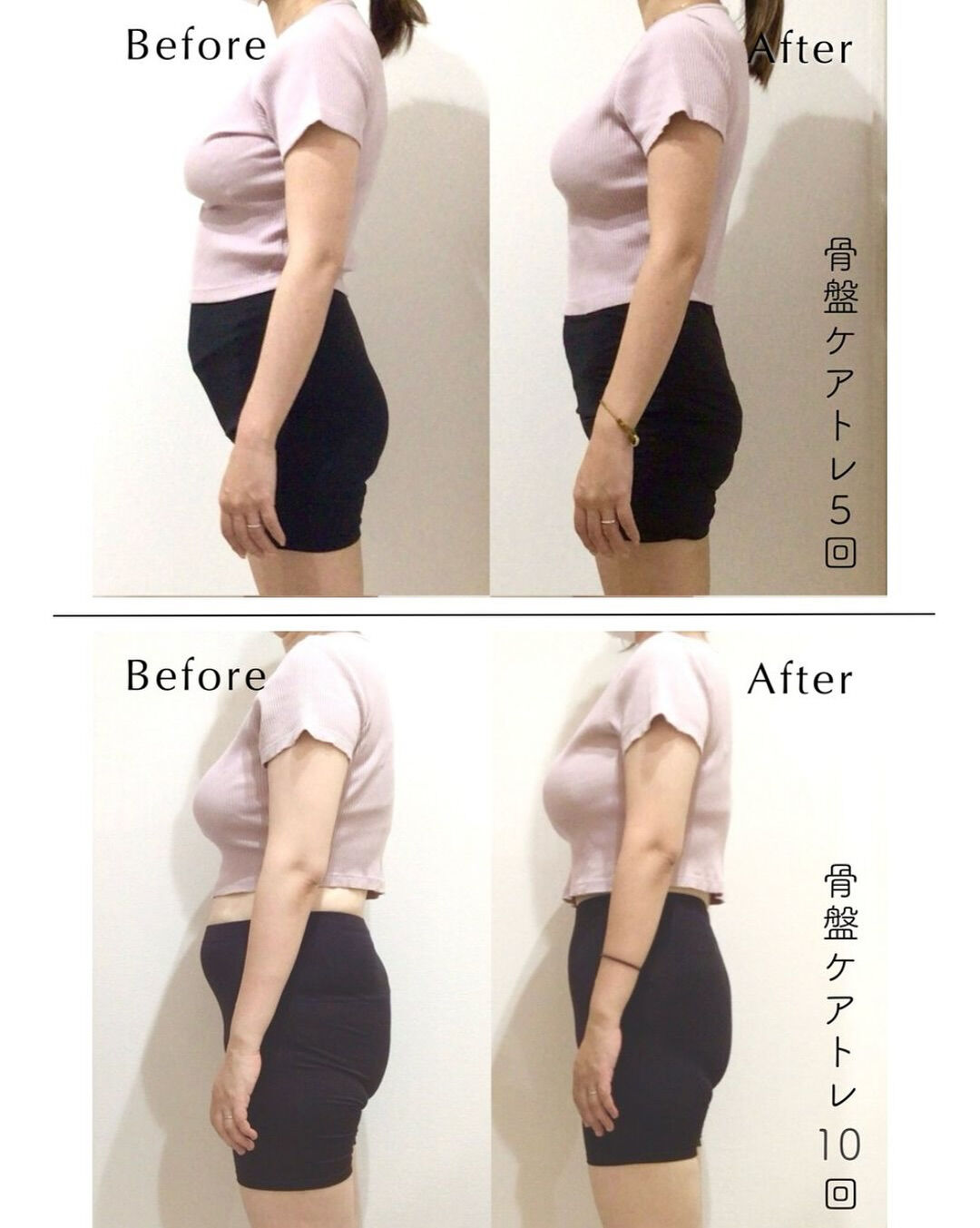 産後のお腹で悩んでいる方へ