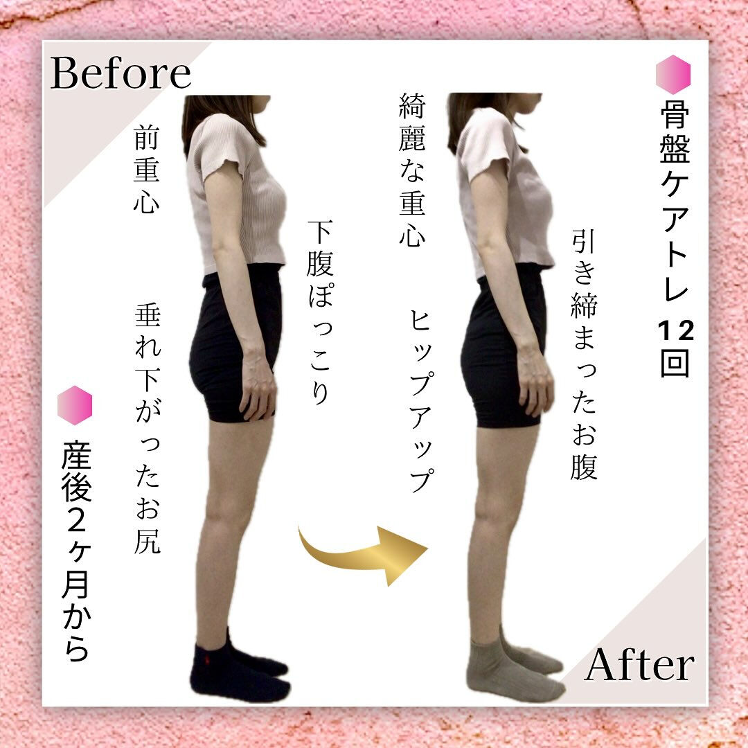 お客様Before Afterのご紹介🙋🏻‍♀️