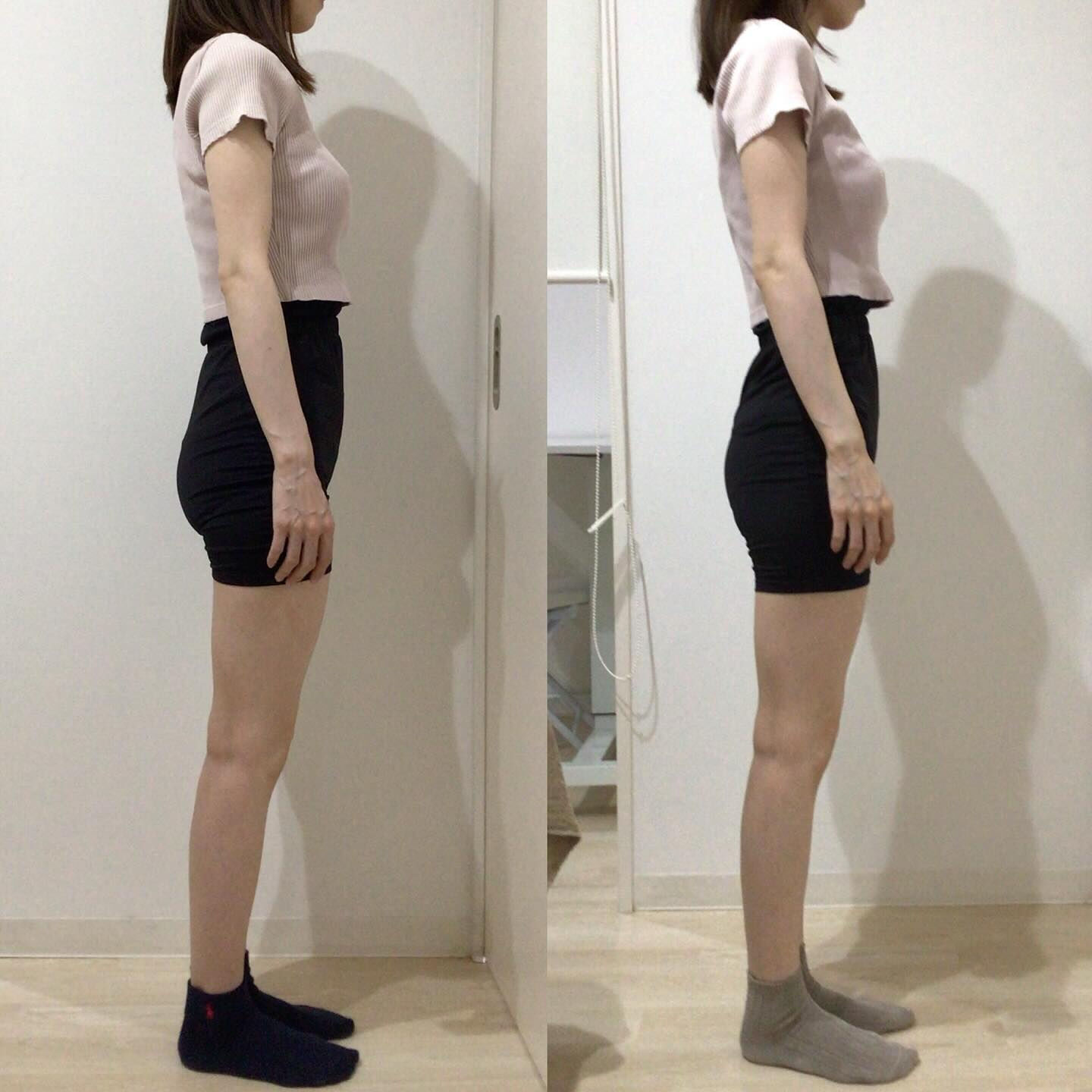 お客様Before Afterのご紹介🙋🏻‍♀️