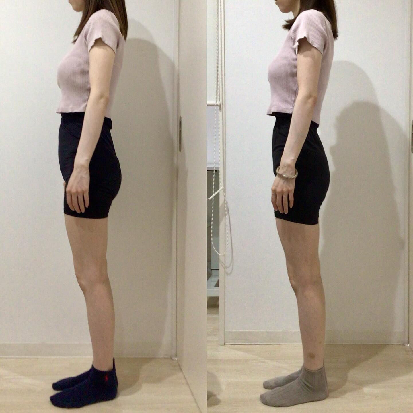 お客様Before Afterのご紹介🙋🏻‍♀️