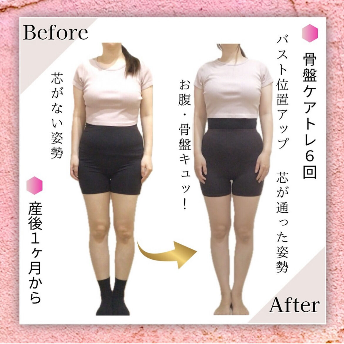 産後ママの骨盤ケアトレBeforeAfter❤️‍🔥