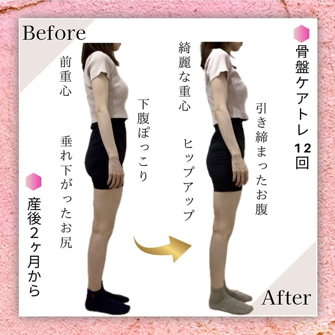 産後ママの骨盤ケアトレBeforeAfter❤️‍🔥