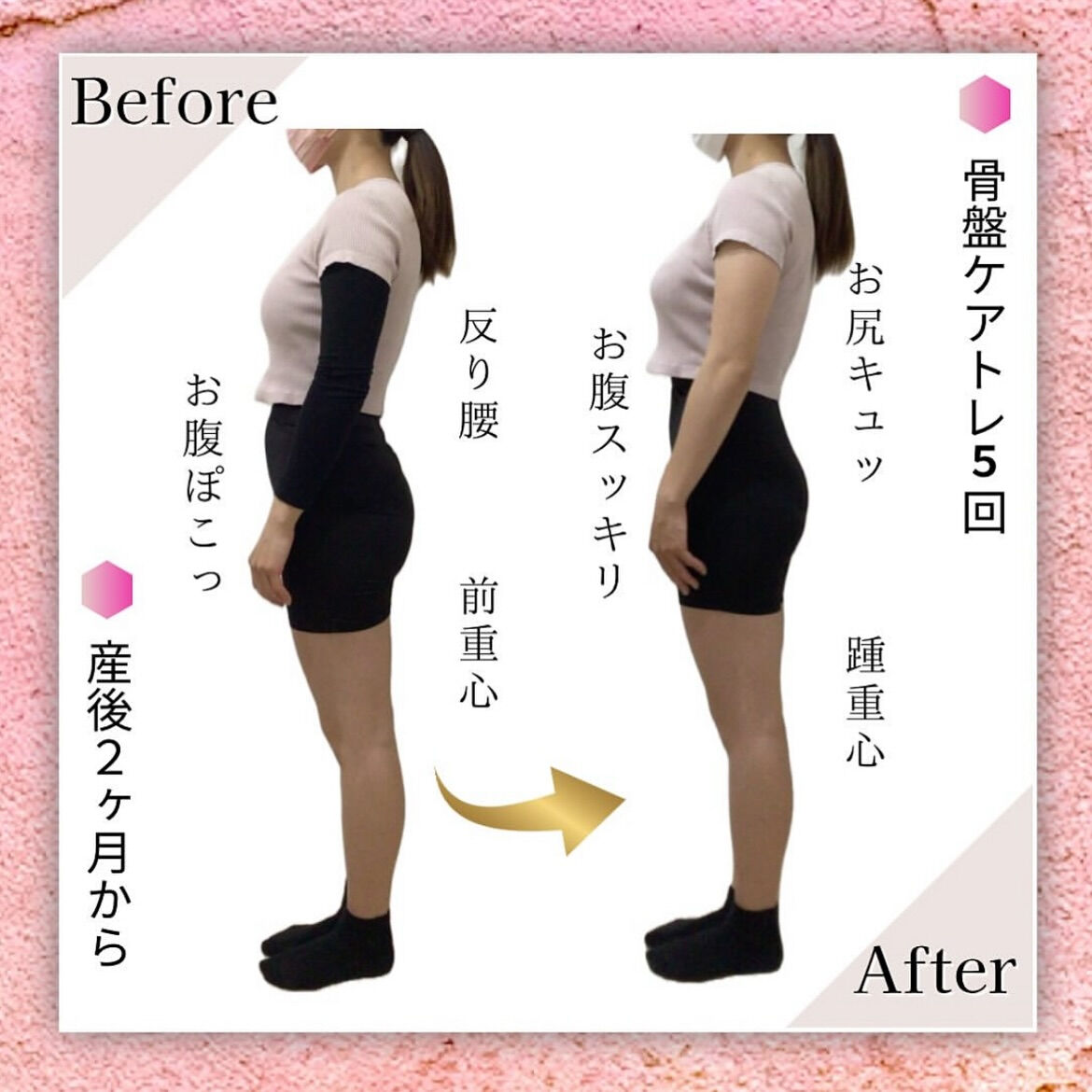 産後ママの骨盤ケアトレBeforeAfter❤️‍🔥