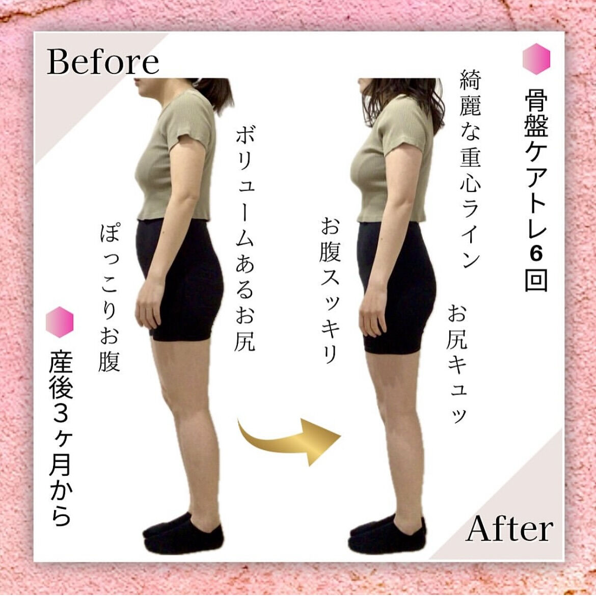 産後ママの骨盤ケアトレBeforeAfter❤️‍🔥