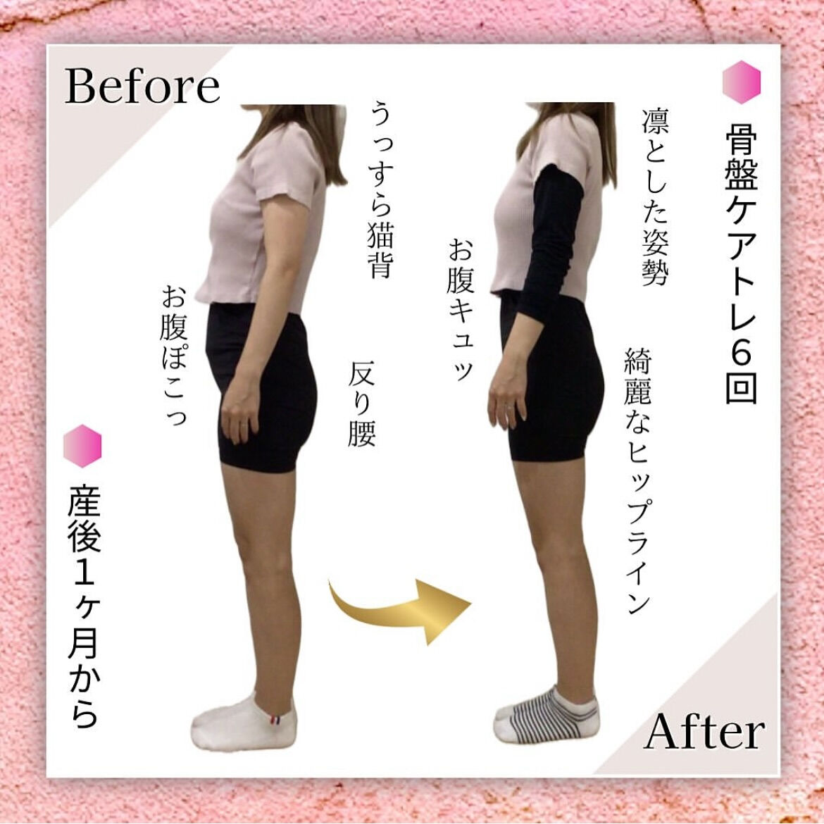 産後ママの骨盤ケアトレBeforeAfter❤️‍🔥