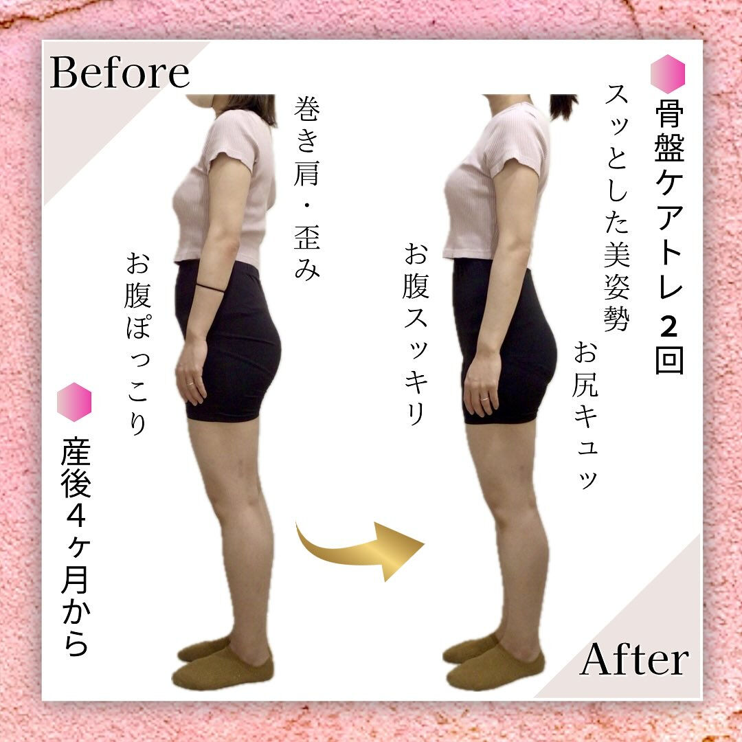 お客様Before Afterのご紹介🙋🏻‍♀️