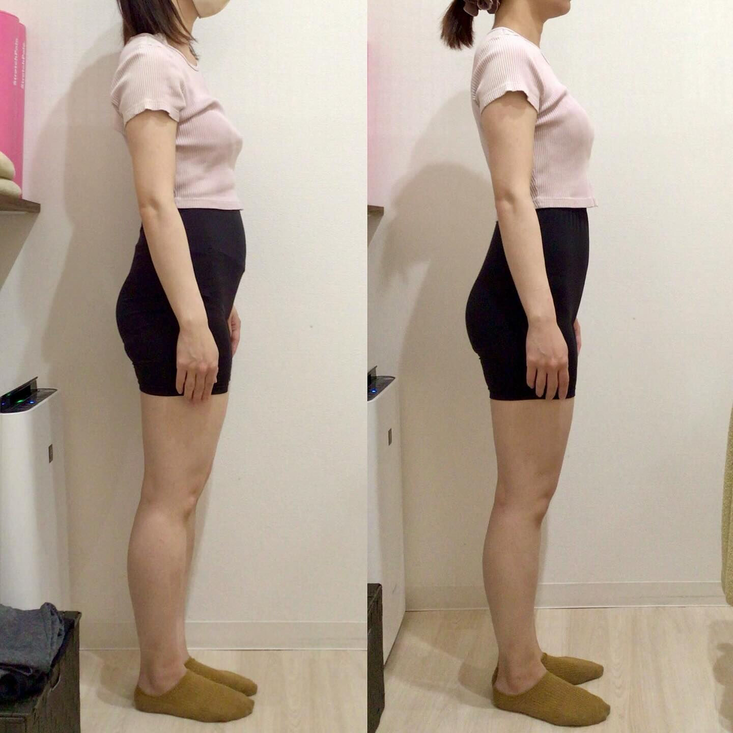 お客様Before Afterのご紹介🙋🏻‍♀️