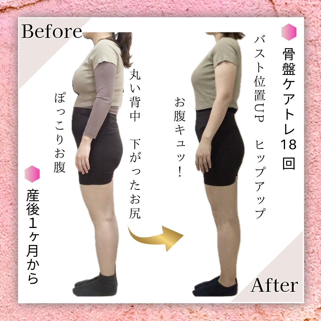 産後骨盤ケアトレ｜お客様BeforeAfterのご紹介