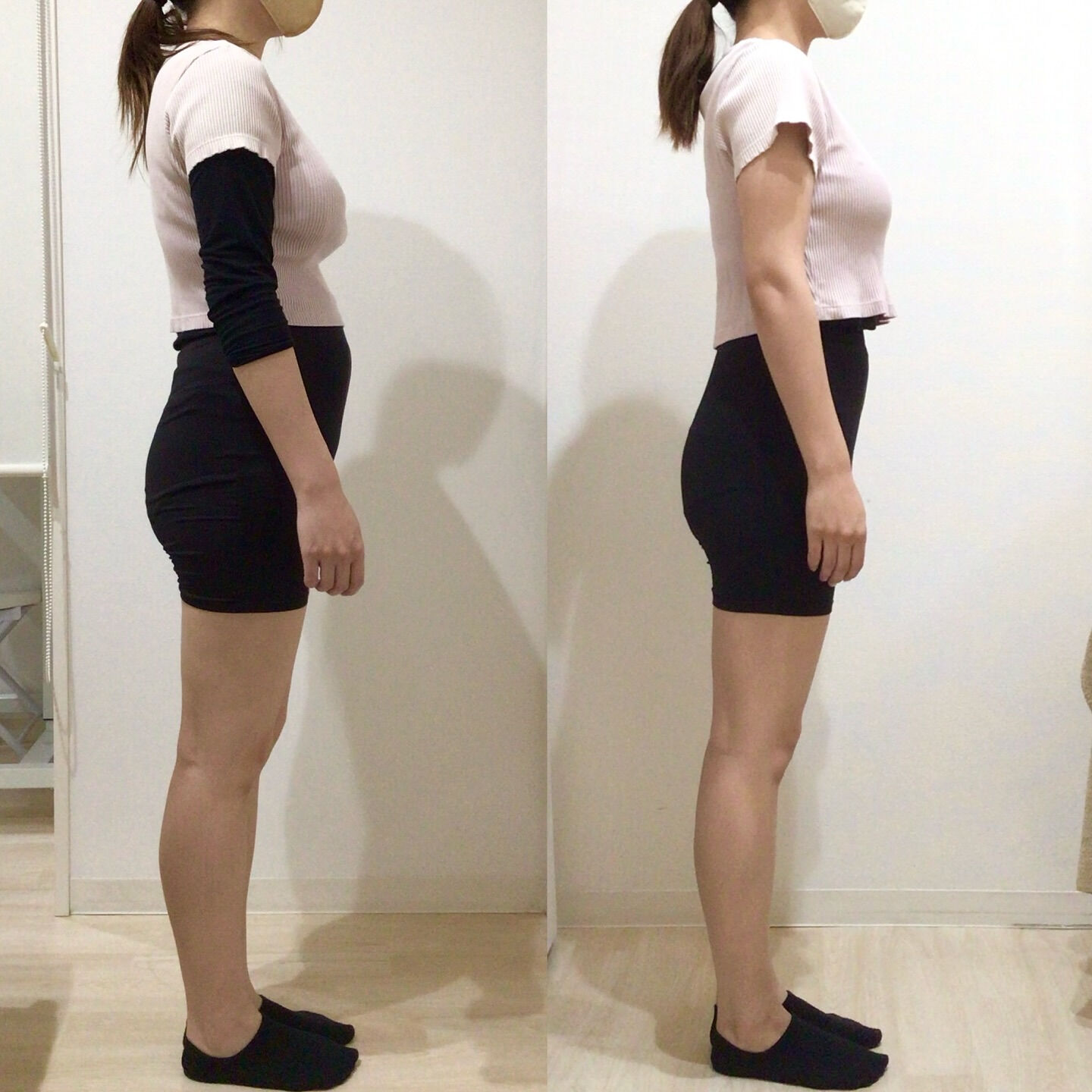 産後腹直筋離開｜お客様BeforeAfter