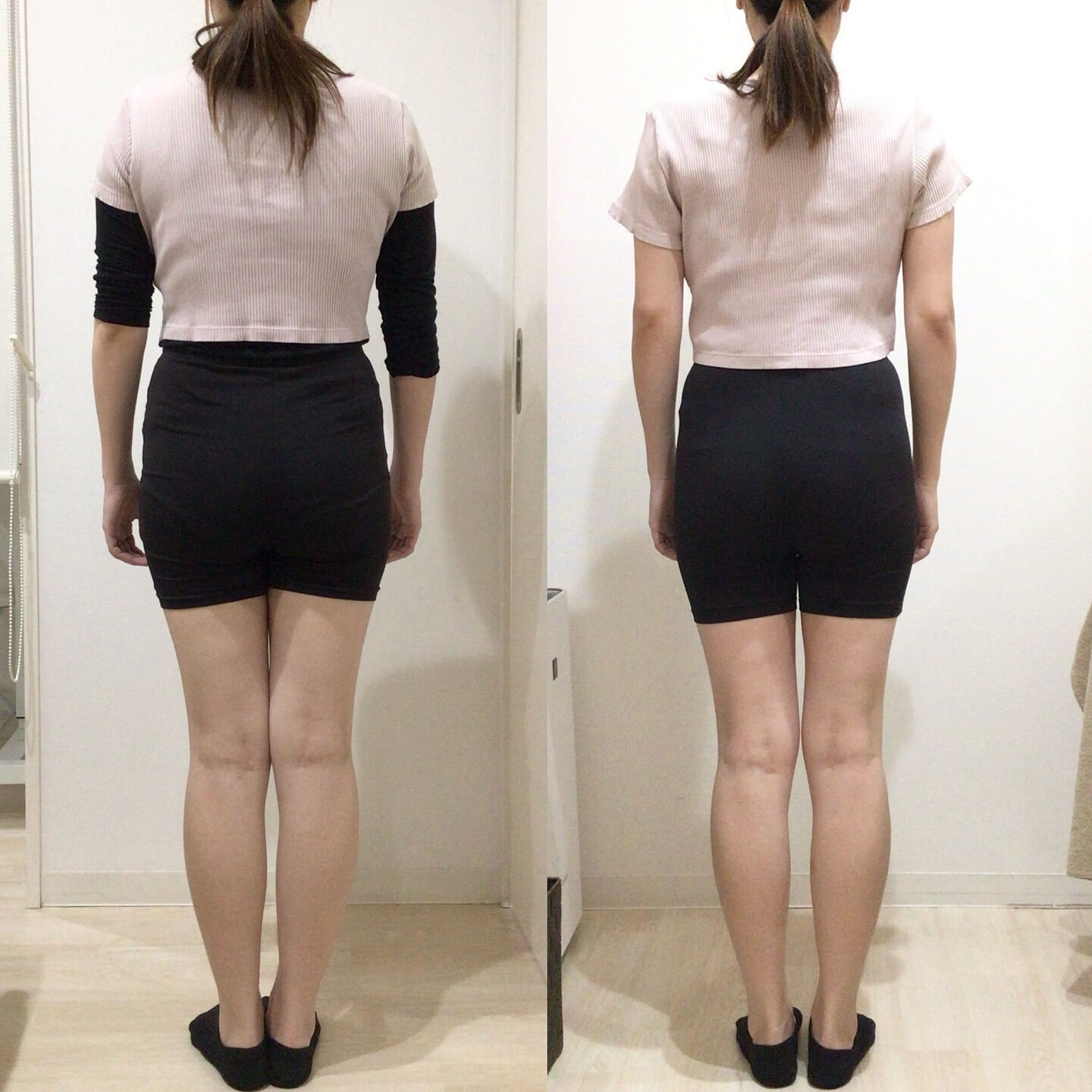 産後腹直筋離開｜お客様BeforeAfter