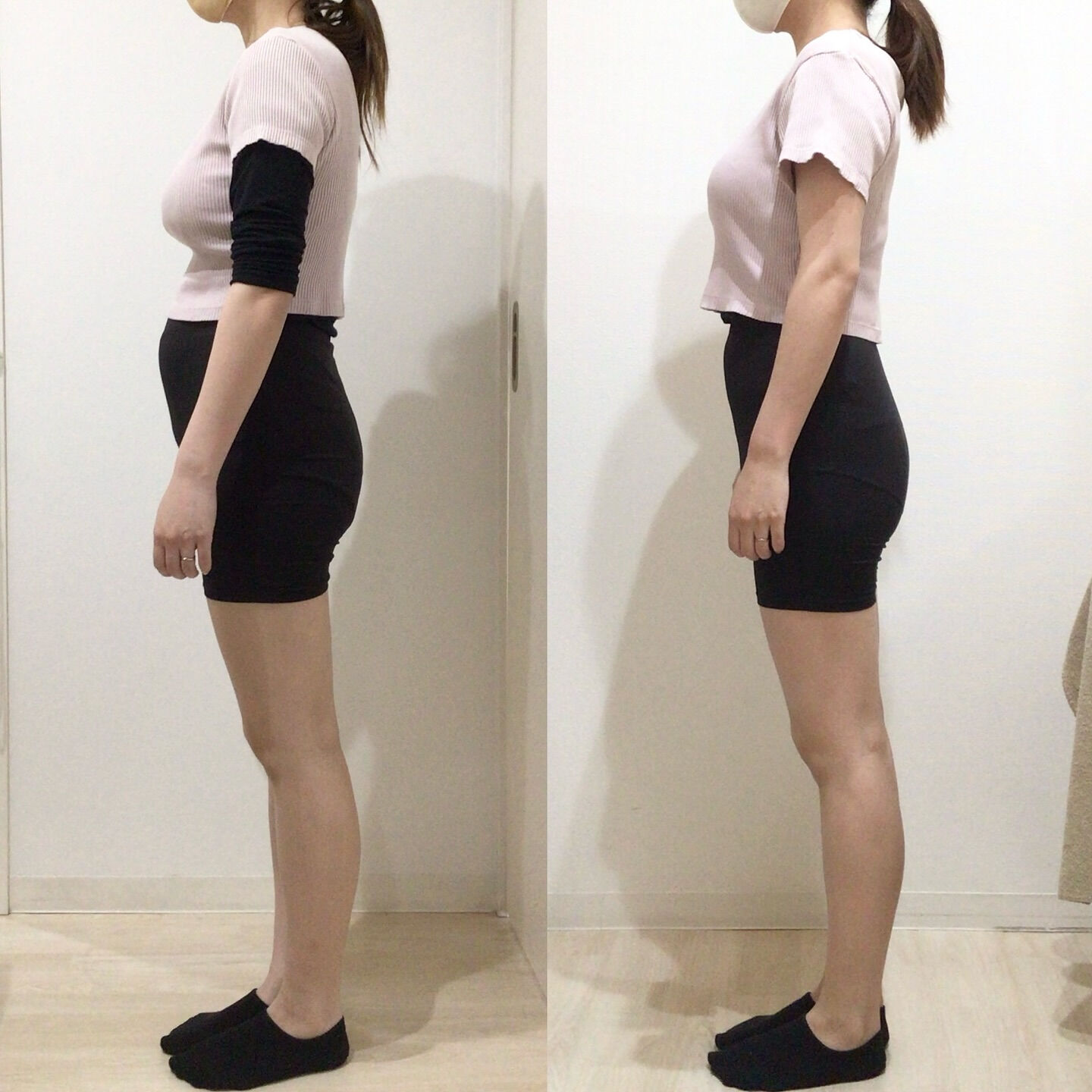 産後腹直筋離開｜お客様BeforeAfter