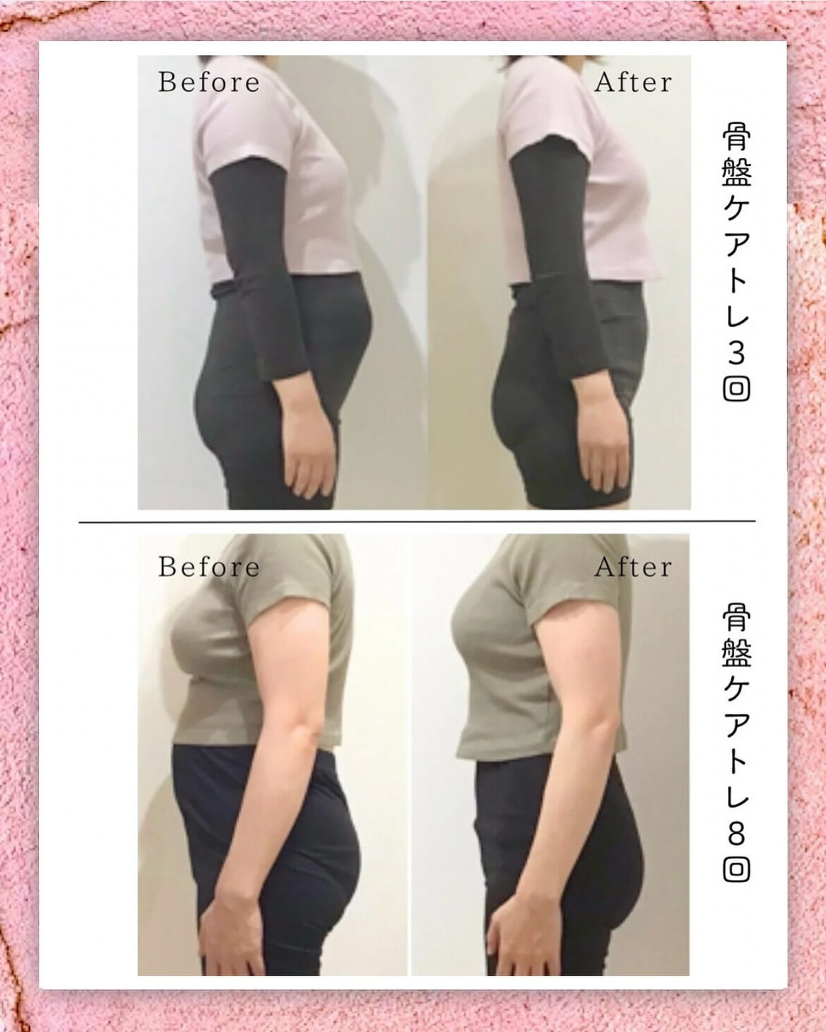 産後欠かせない！骨盤底筋エクササイズ