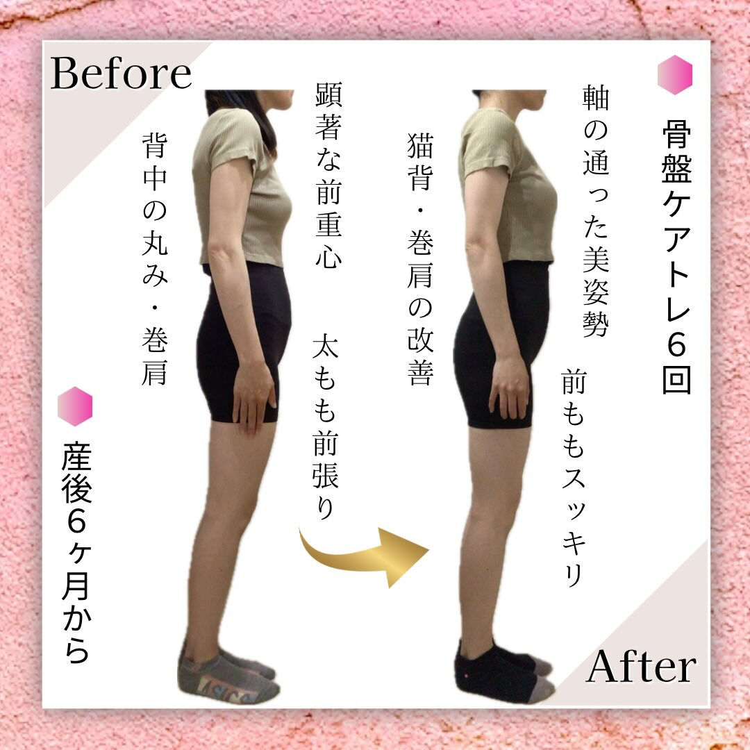 お客様Before Afterのご紹介🙋🏻‍♀️