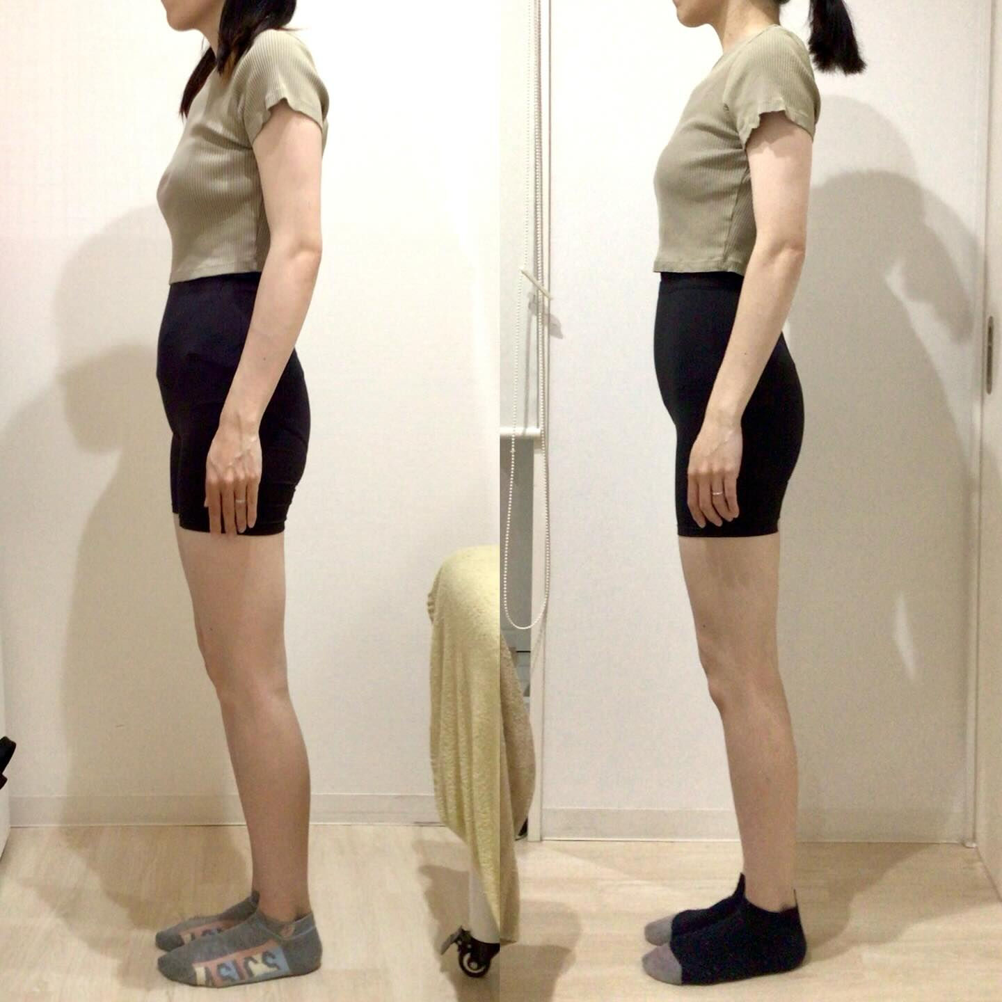 お客様Before Afterのご紹介🙋🏻‍♀️