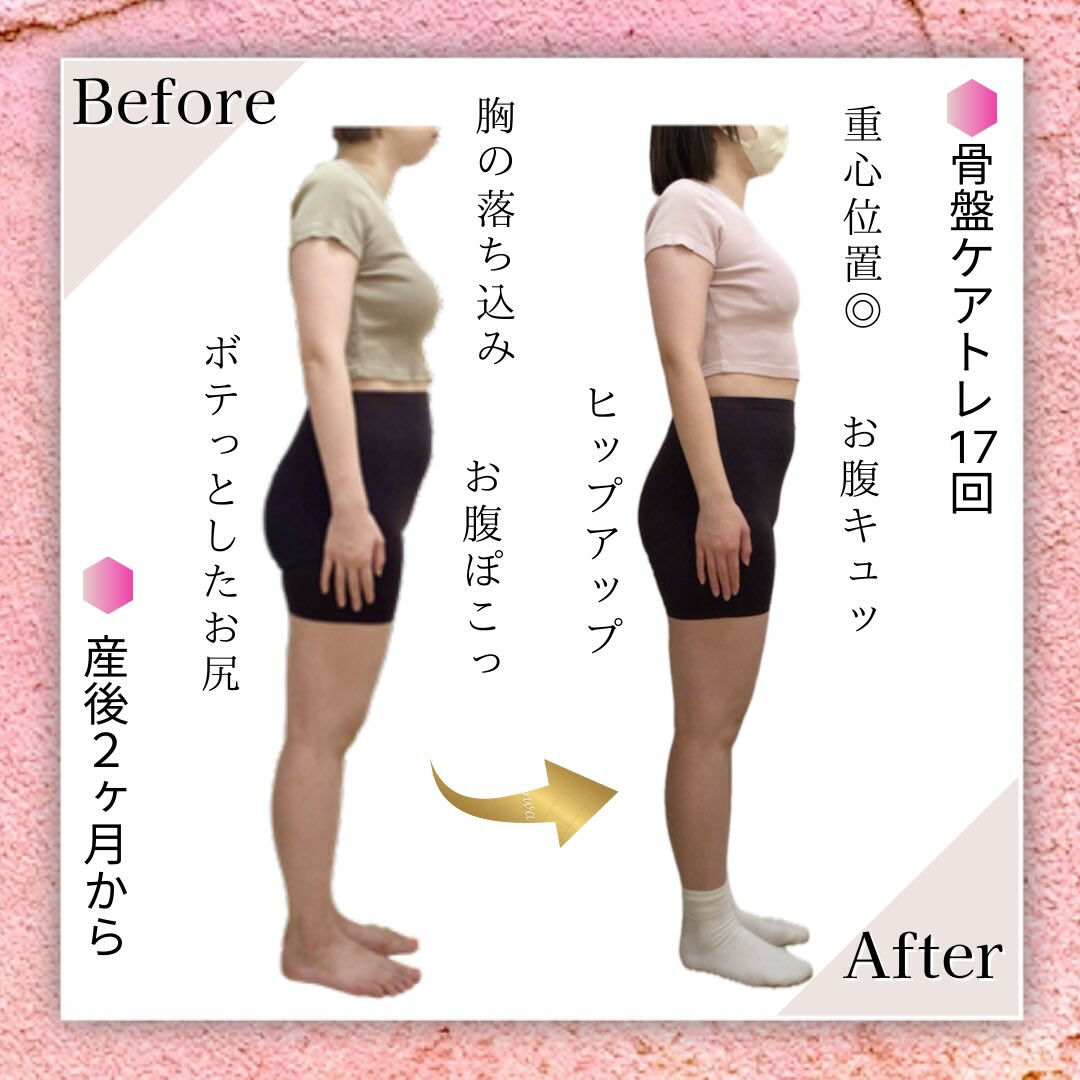 お客さまのbefore･afterのご紹介🧏🏻‍♀️