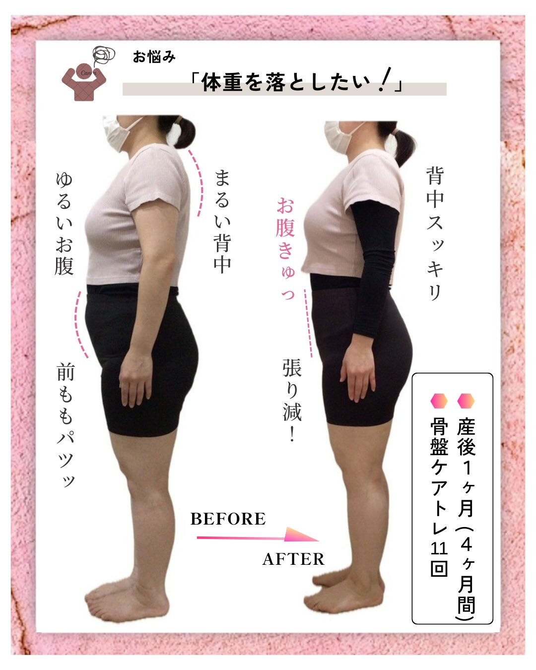お客さまのbefore･afterのご紹介👩🏻‍🍼