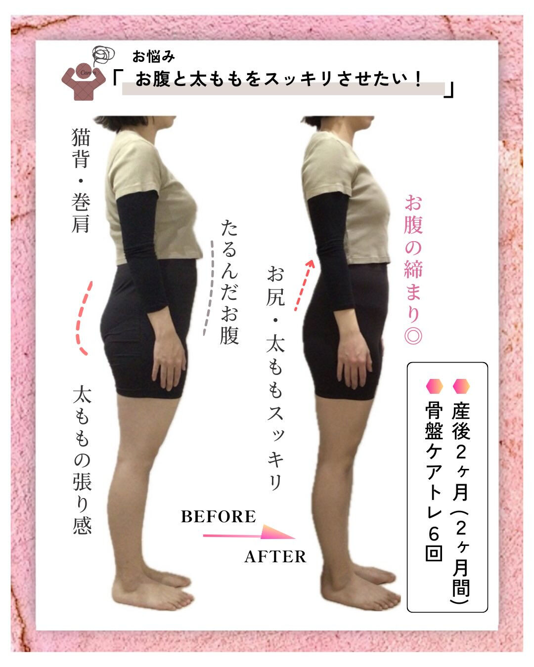3人目出産ママの産後Before/Afterご紹介🙋🏻‍♀️