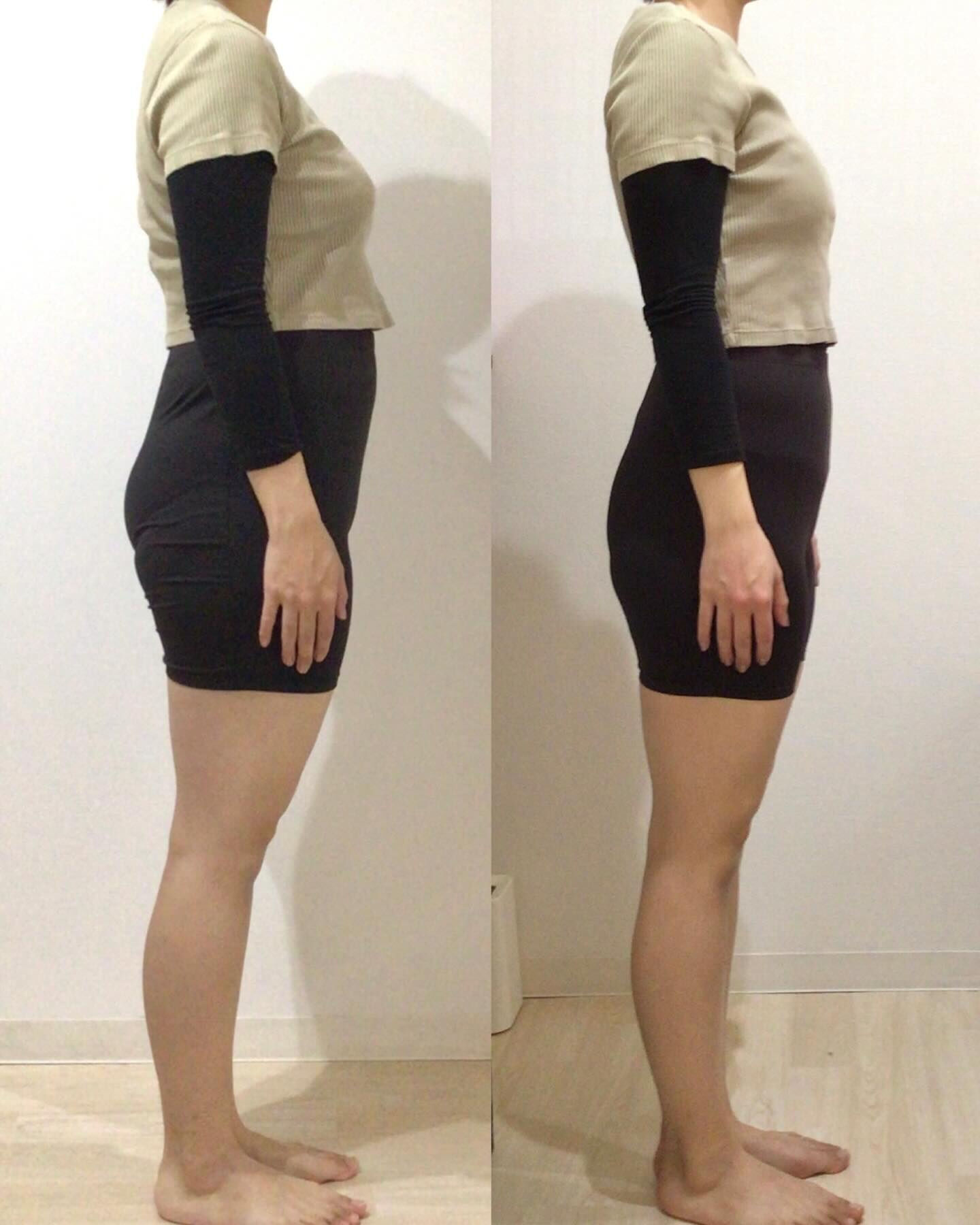 3人目出産ママの産後Before/Afterご紹介🙋🏻‍♀️