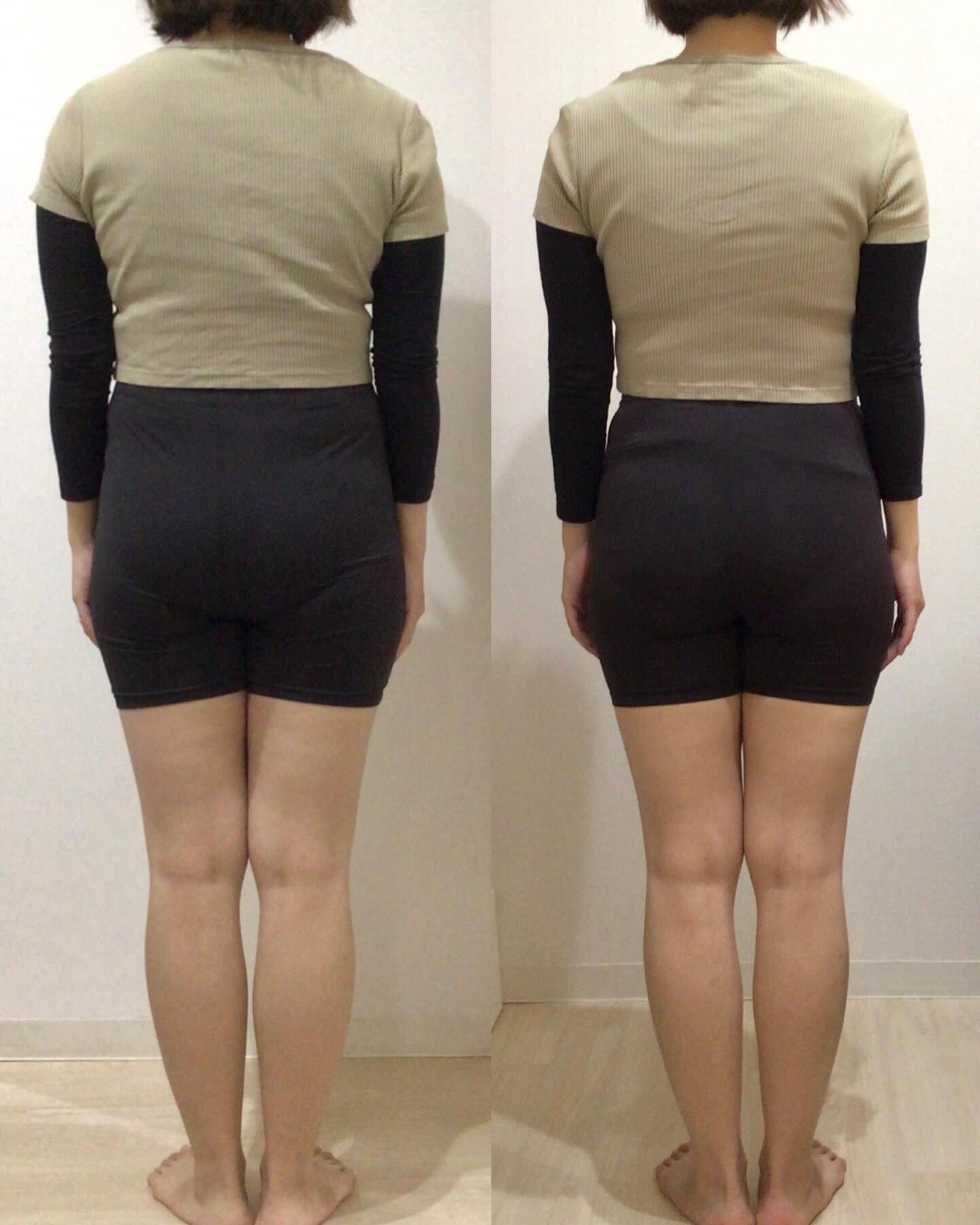3人目出産ママの産後Before/Afterご紹介🙋🏻‍♀️