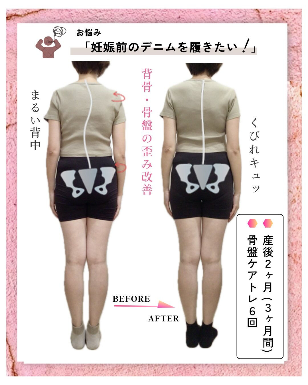 お客さまのbefore･afterのご紹介👧🏻