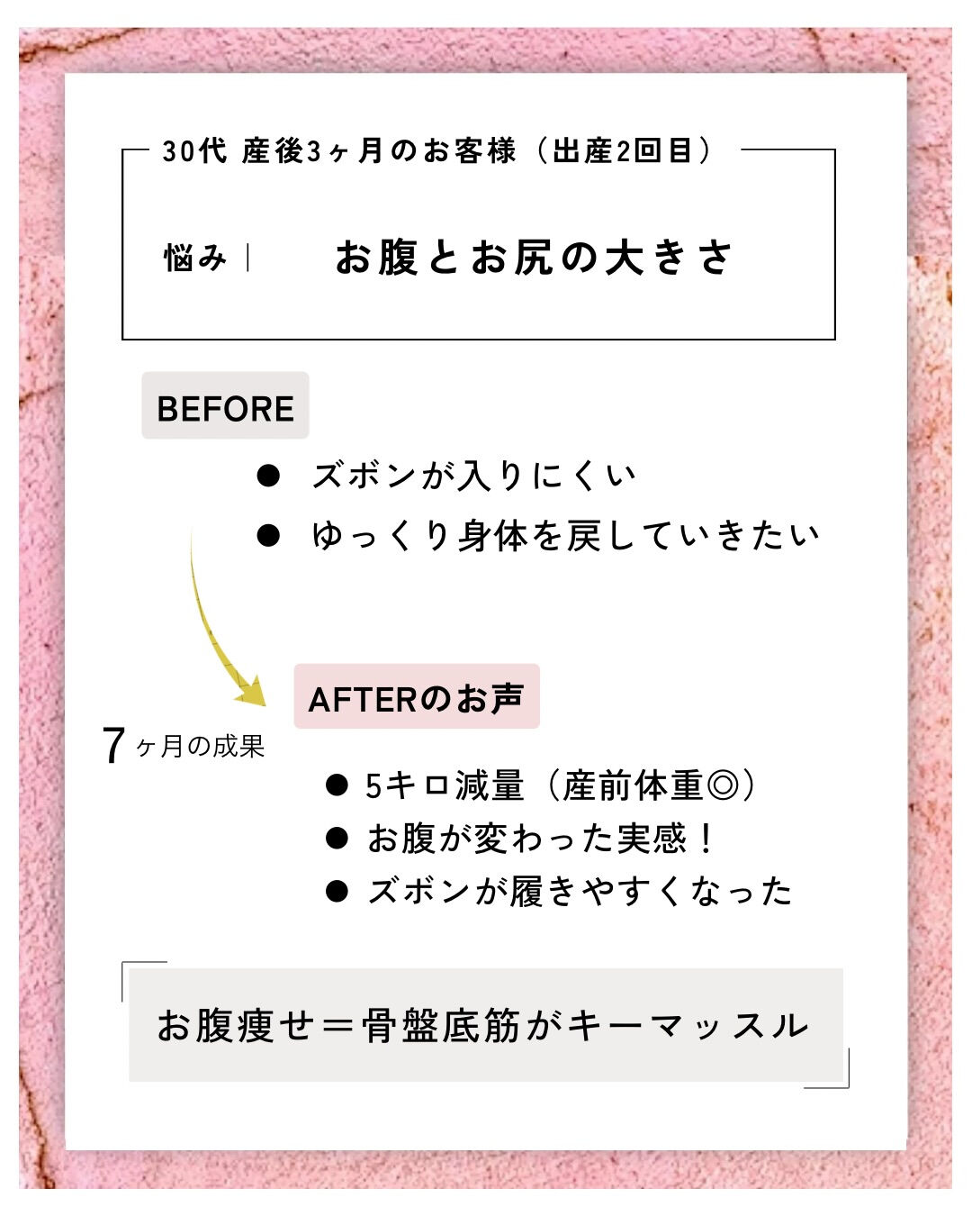 産後の骨盤矯正（骨盤ケアトレ）BeforeAfter