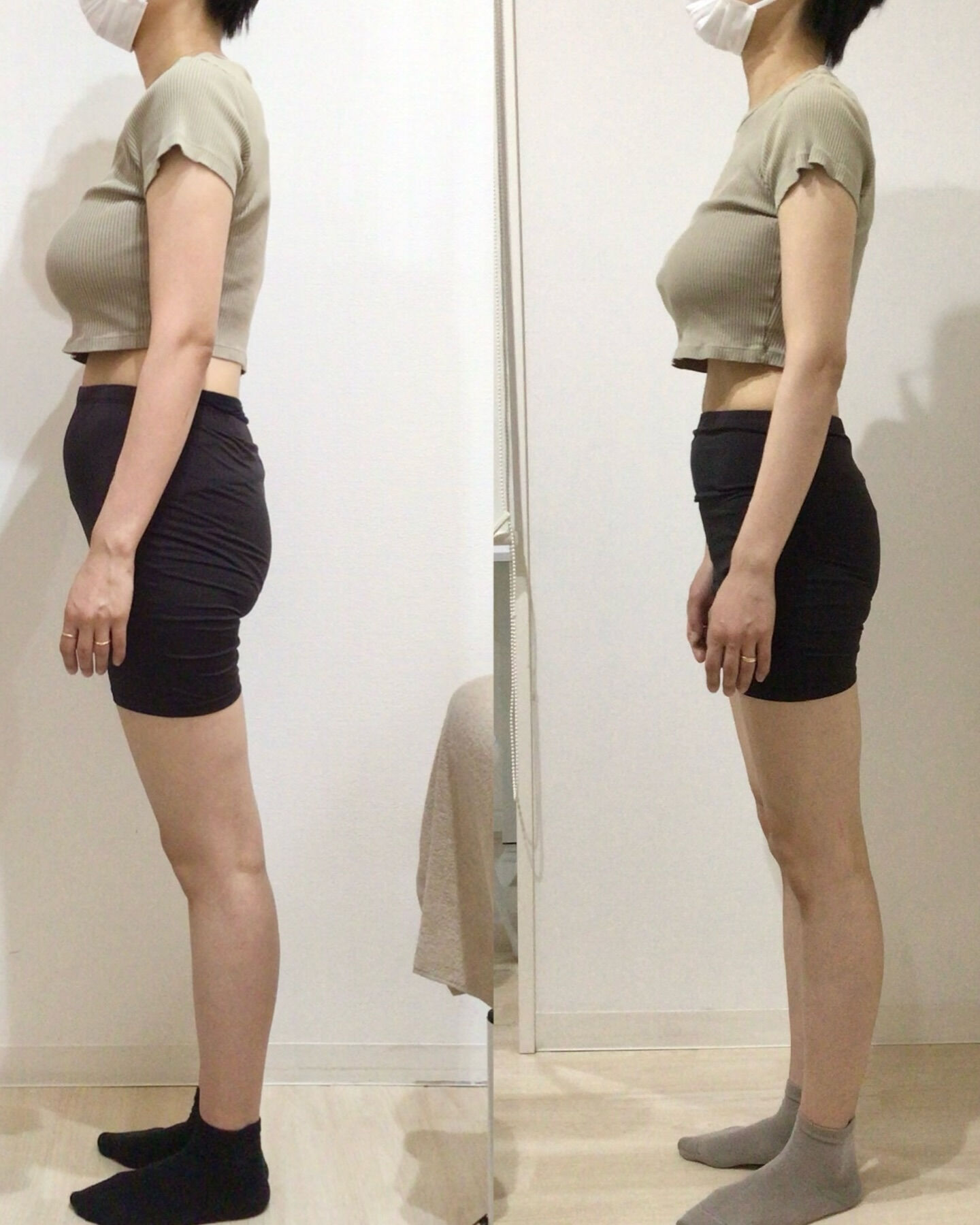 産後の骨盤矯正（骨盤ケアトレ）BeforeAfter