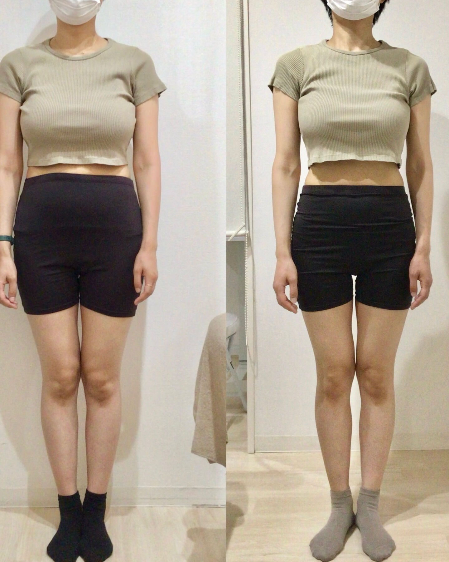 産後の骨盤矯正（骨盤ケアトレ）BeforeAfter