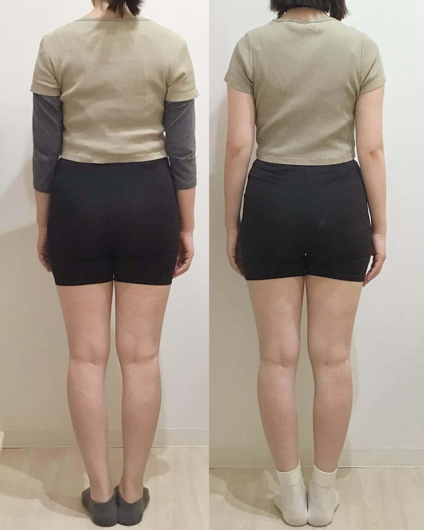 産後の骨盤矯正（骨盤ケアトレ）BeforeAfter
