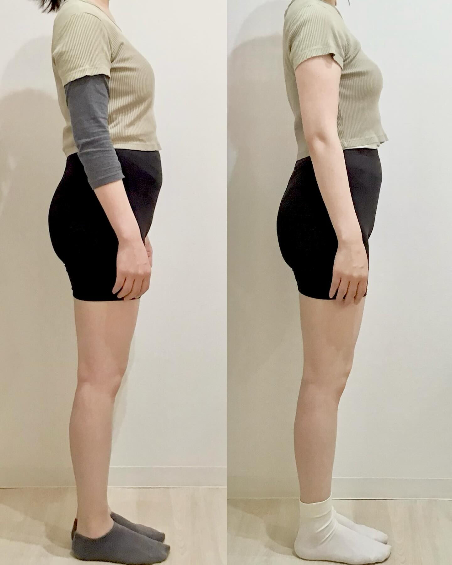 産後の骨盤矯正（骨盤ケアトレ）BeforeAfter