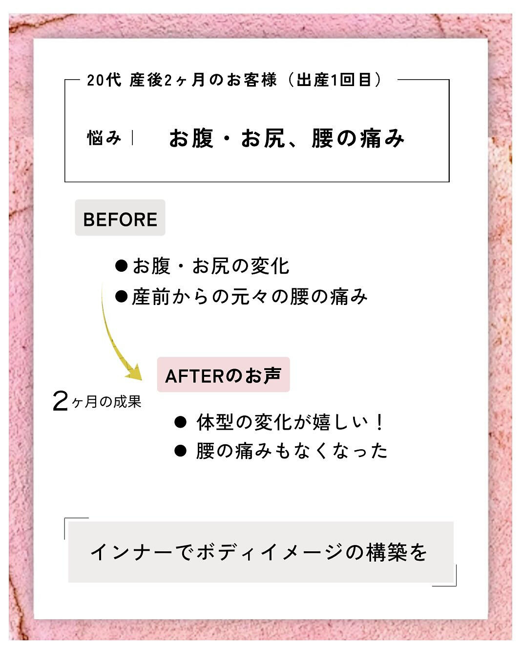 産後の骨盤矯正（骨盤ケアトレ）BeforeAfter