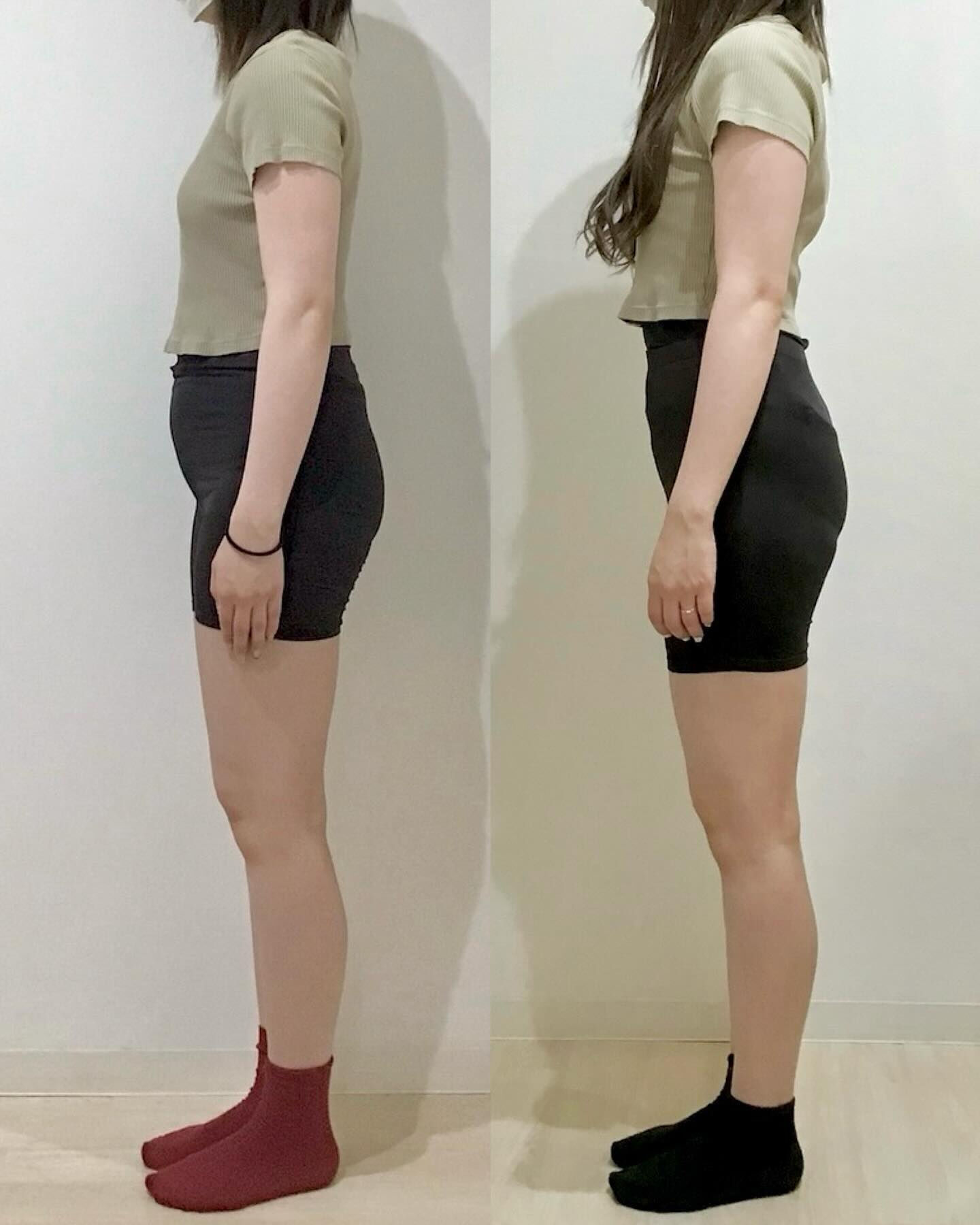 産後の骨盤矯正（骨盤ケアトレ）BeforeAfter