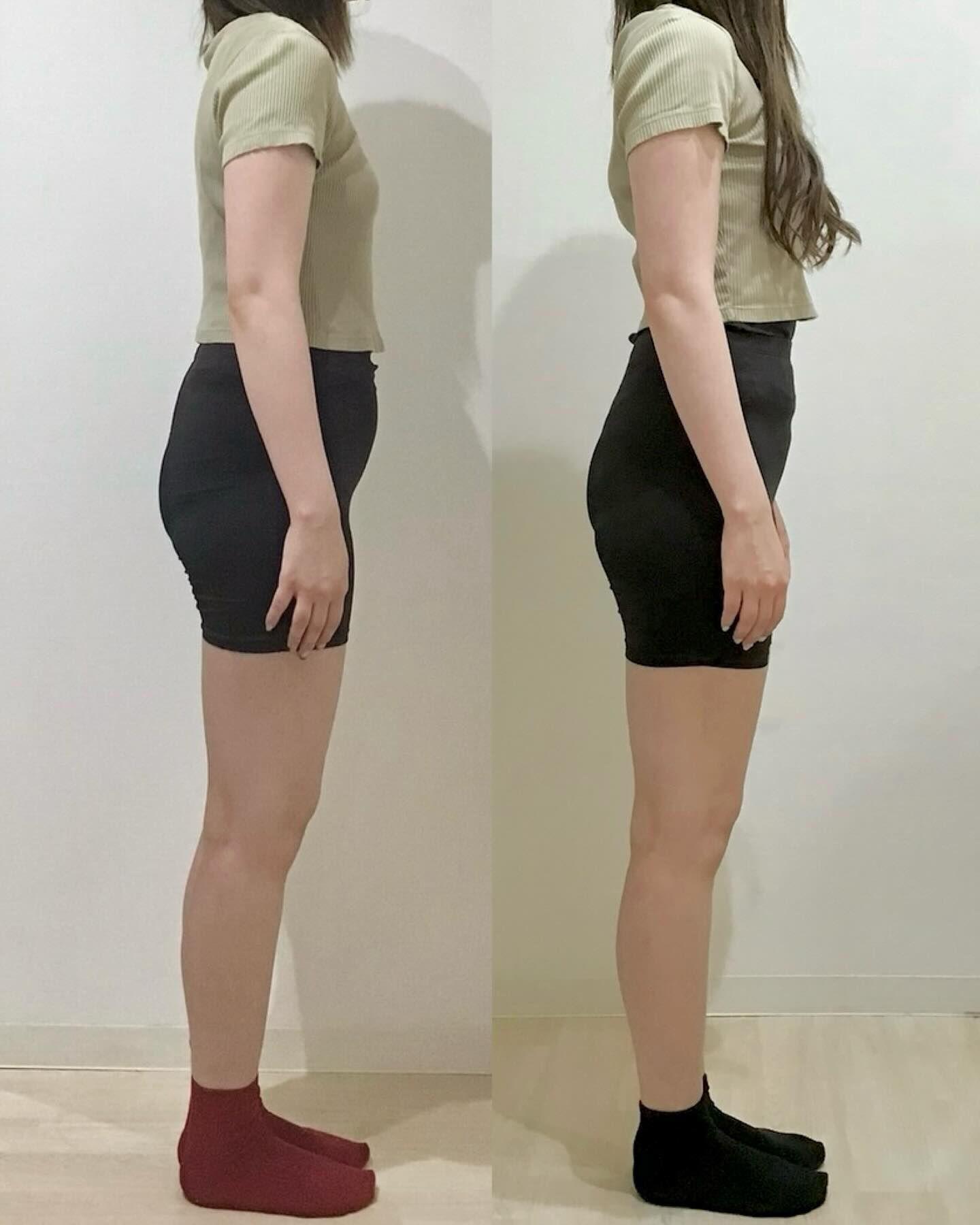 産後の骨盤矯正（骨盤ケアトレ）BeforeAfter