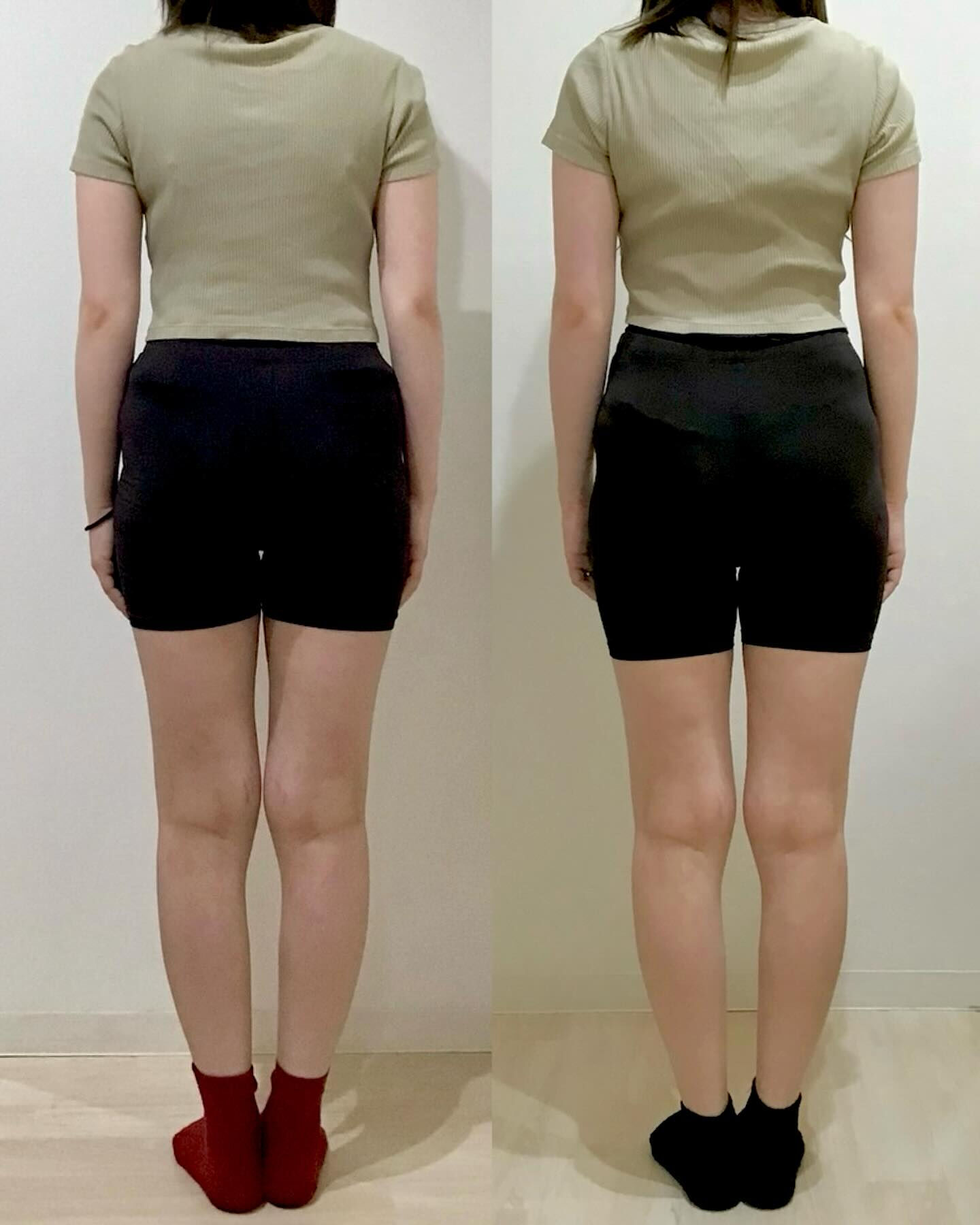 産後の骨盤矯正（骨盤ケアトレ）BeforeAfter