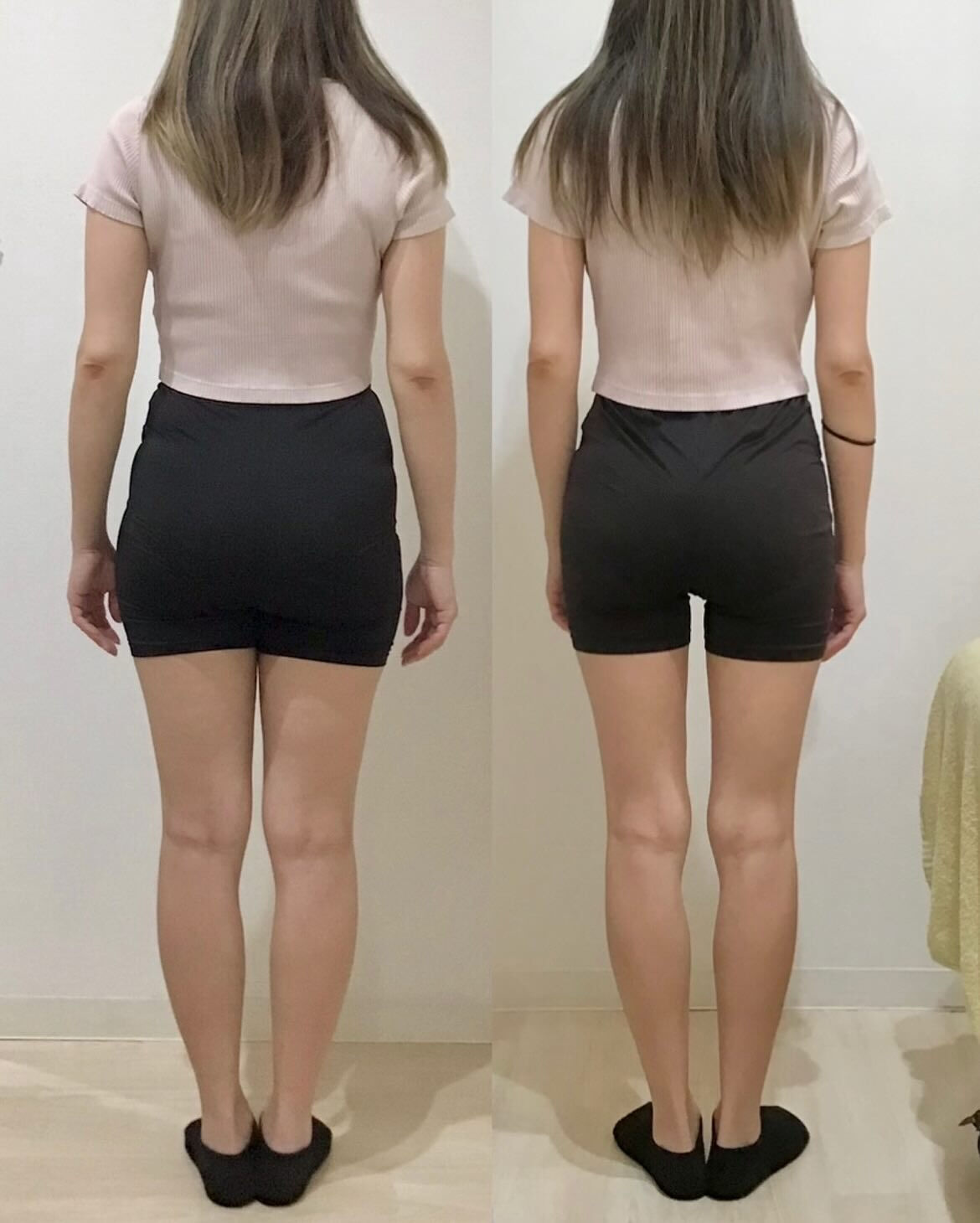 産後の骨盤矯正（骨盤ケアトレ）BeforeAfter