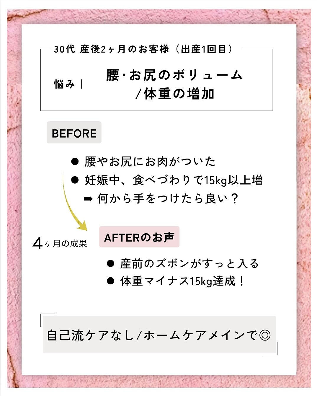 産後の骨盤矯正（骨盤ケアトレ）BeforeAfter